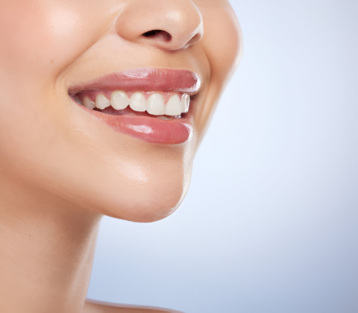 Safe Teeth Whitening: Why Professional Treatments Are the Best Choice_FI